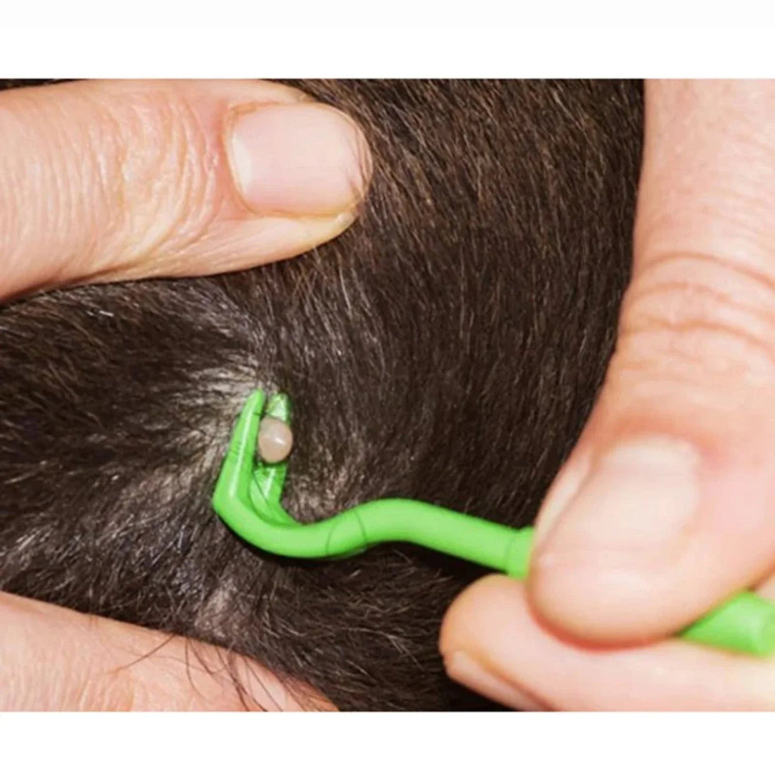 Zeckenentferner-Set aus Kunststoff für Hunde, Katzen und Menschen – 3 Größen, ohne Quetschen, ohne Chemie, wiederverwendbar, 3 Stück